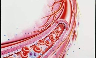 血管里有大秘密，贝斯曼超声多普勒血流检测仪助您预防外周血管疾病