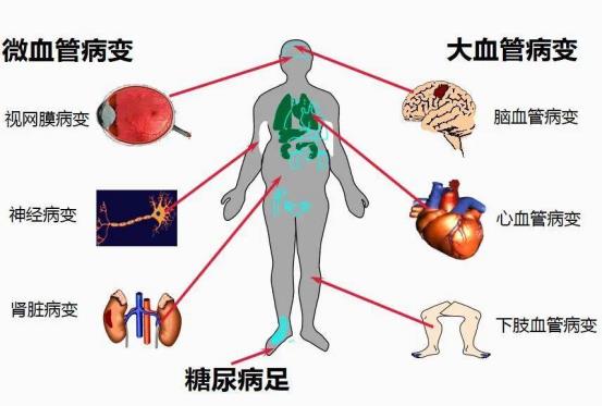 血管健康您在乎过吗？